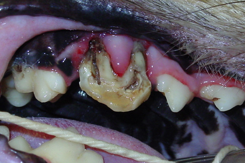 Exodontia (Extracting teeth)