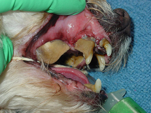 Professional Scale and Polish (Prophy)