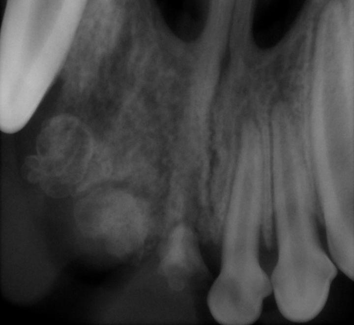 Dental Column July 2010 - Abnormal Teeth (1)