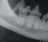 Furcation Defect April 2009-02