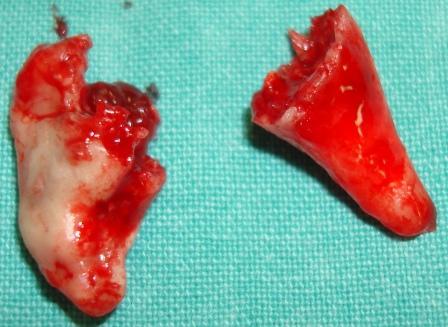 German shepherd dog with- Osteomyelitis (5)