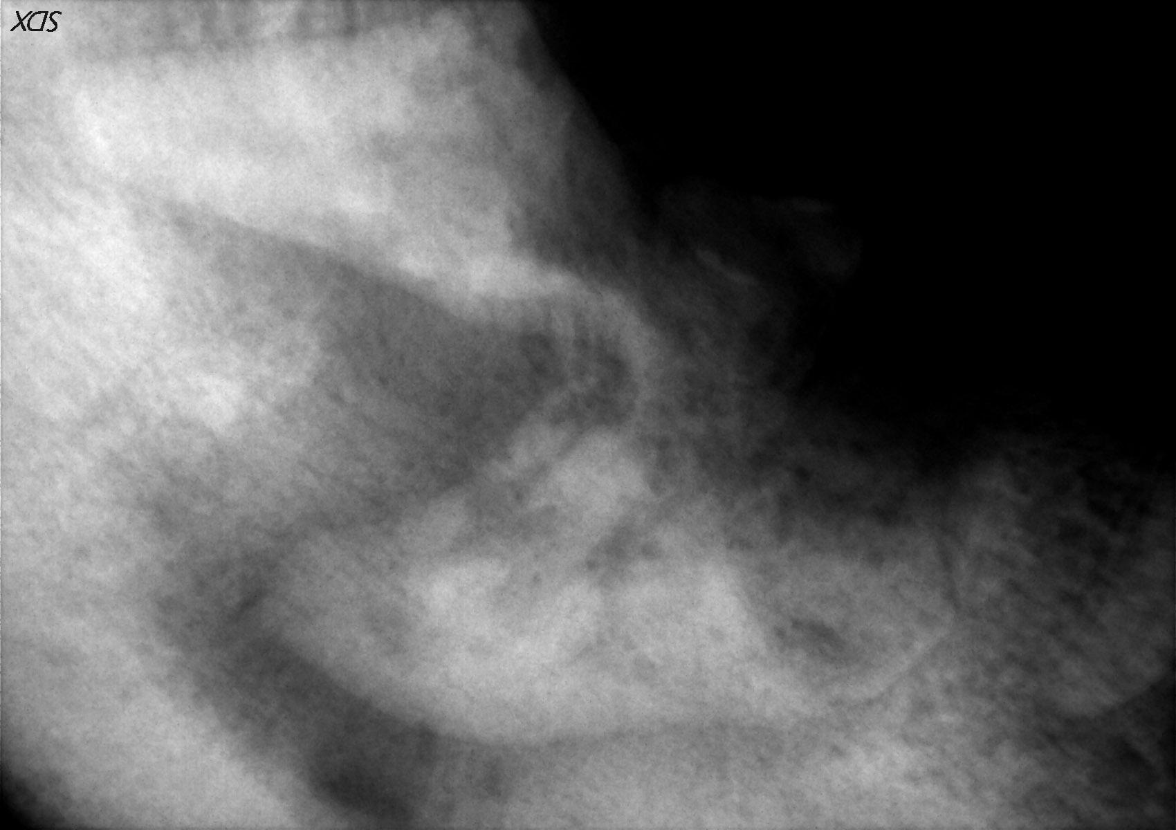 German shepherd dog with- Osteomyelitis (4)