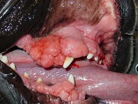 Gingival Hyperplasia - Overgrowth July 2009