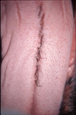 Hair On Dogs Tongue March 2008-03