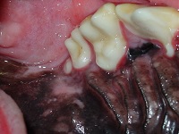 Hyperdontia Supernumerary Tooth Dec 2008-02