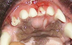 Pulp Exposure Aug 2009-02