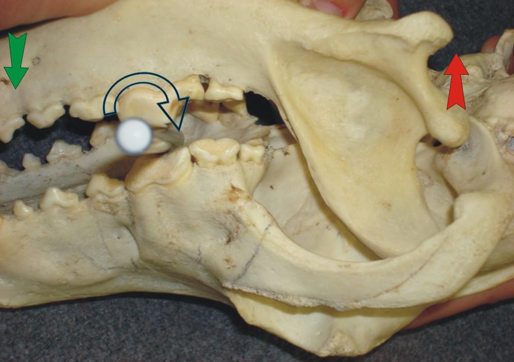 TMJ Reduction -Luxation of the left condyle 02
