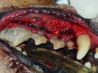 Tooth Luxation Avulsion 03